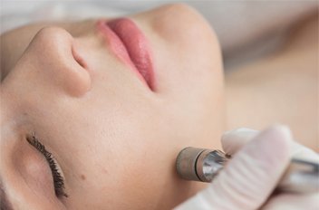 Tratamento facial de peeling de diamante